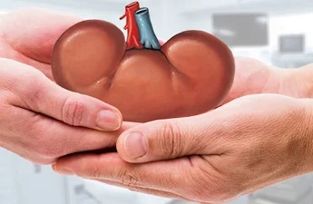 Medical Travel for Kidney Transplant: A Comprehensive Guide